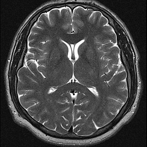 МРТ головного мозга в СПб: что показывает, преимущества и правила подготовки